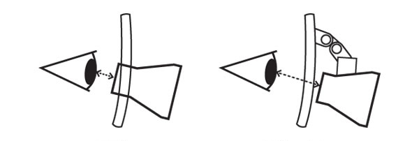 dental loupe 5