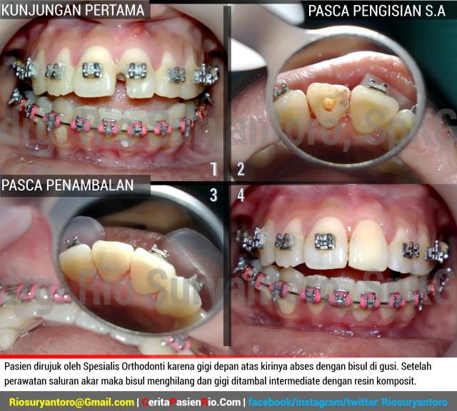 estetika 4