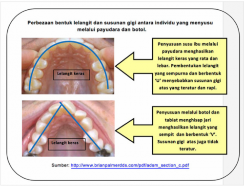 hisap-gigi-1