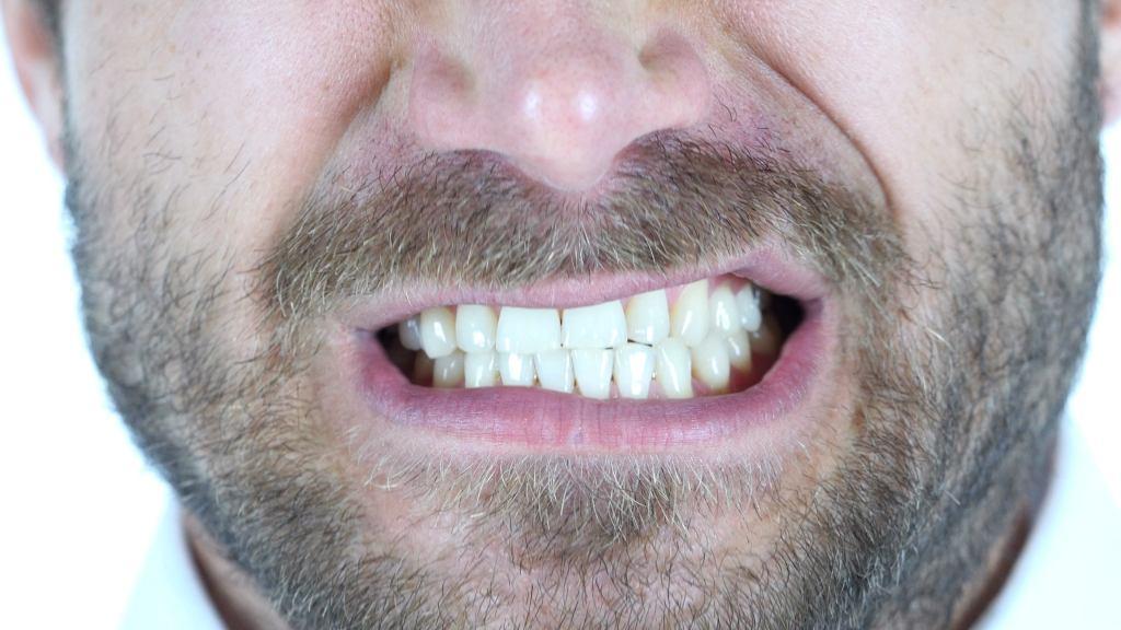 Apa Penyebab Bruxim Dan Apakah Bruxism Berbahaya